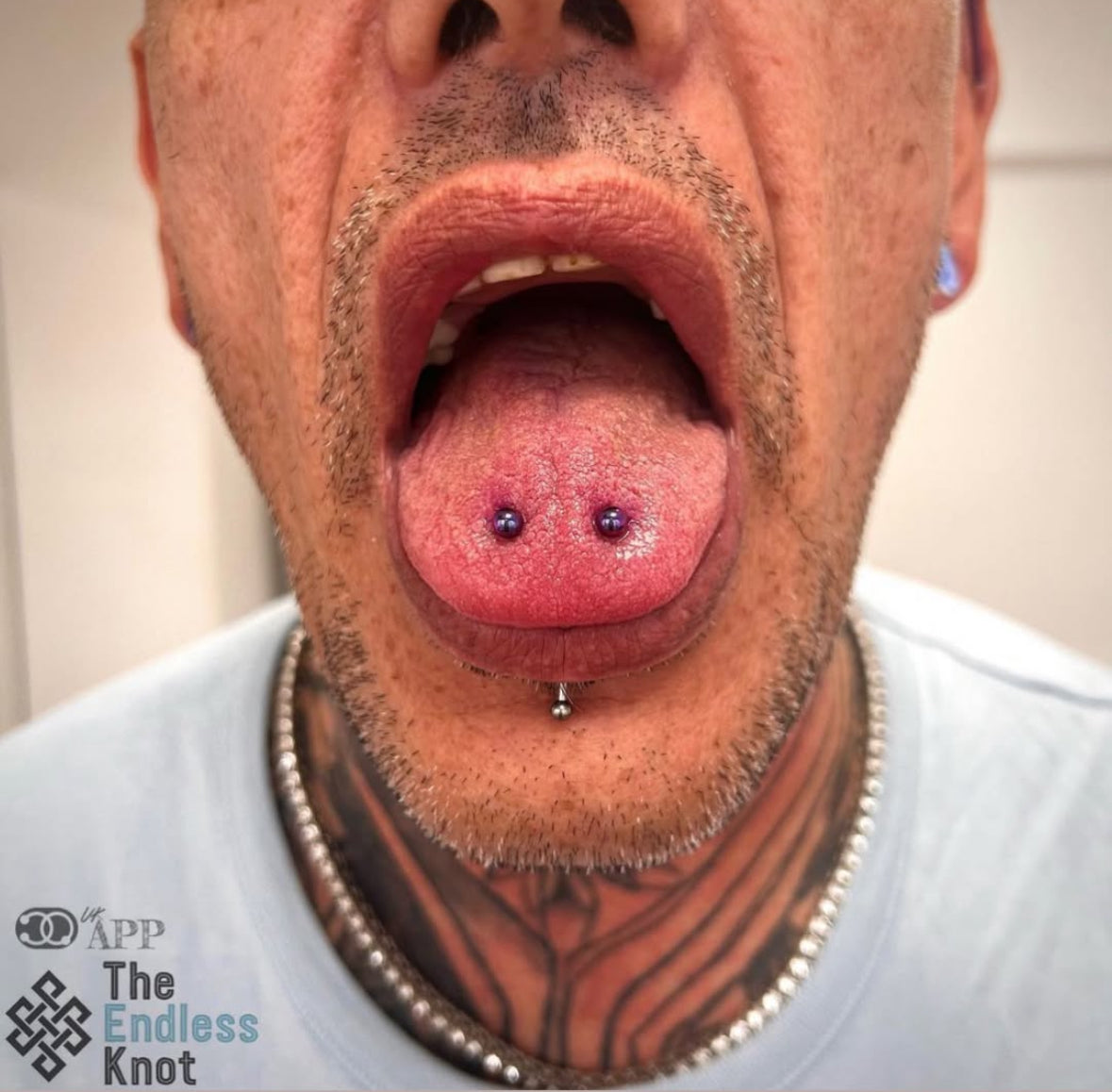 Tongue bar
