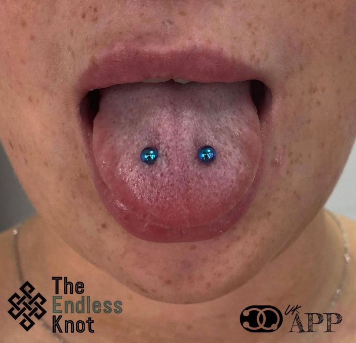 Tongue bar
