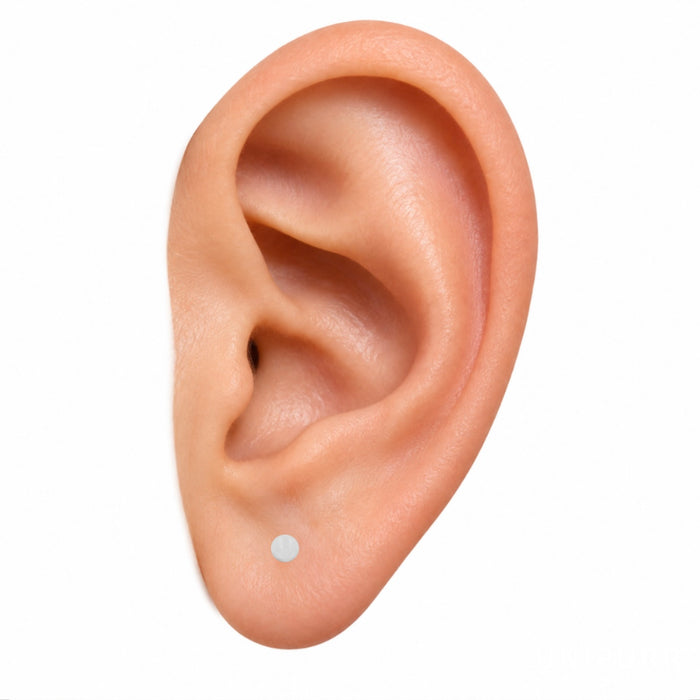 Lobe