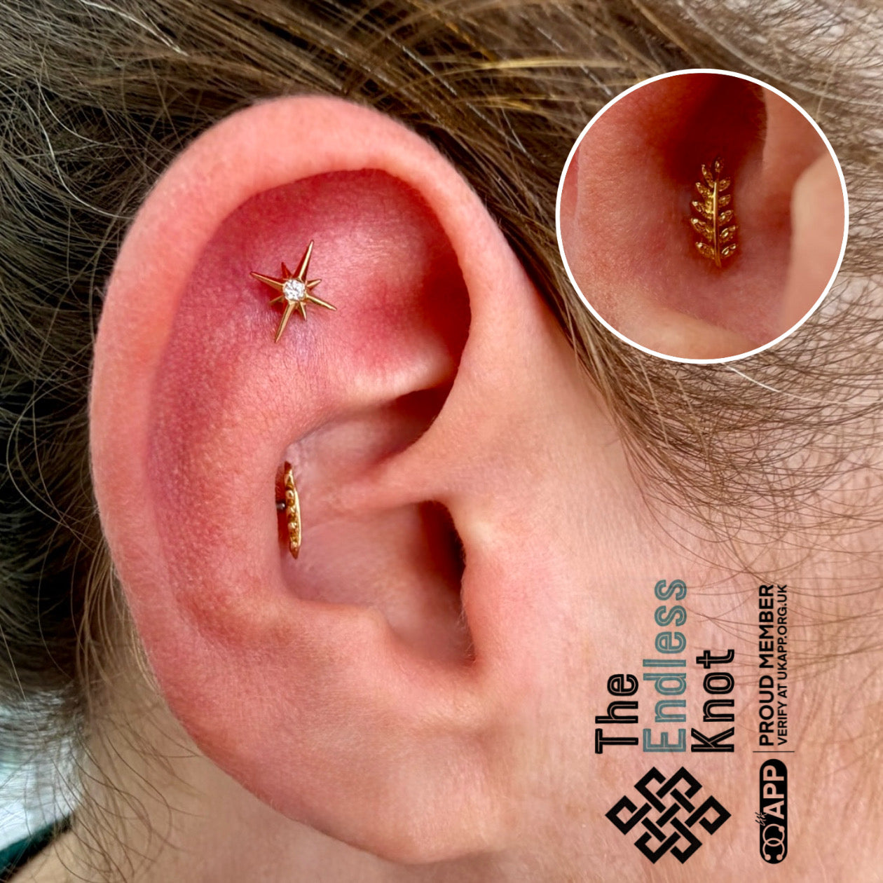 Ear cartilage (with labret)