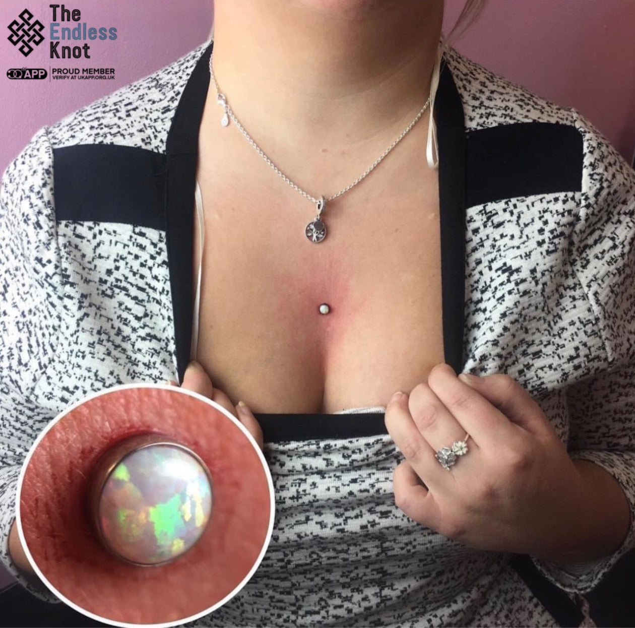 Dermal (One point piercing) / Surface