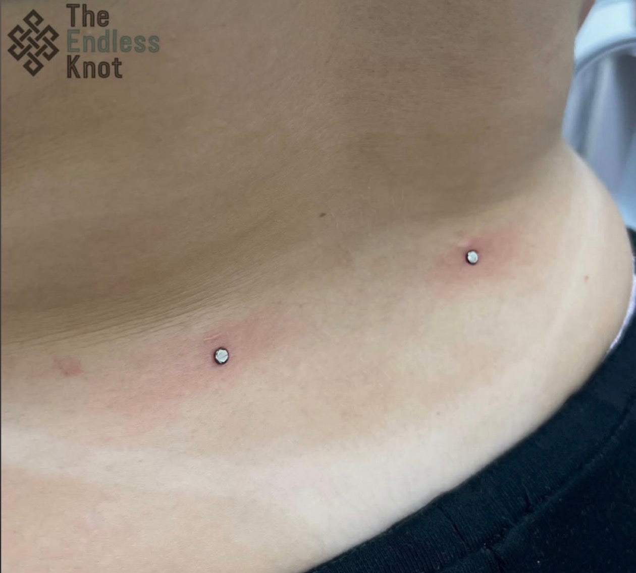 Dermal (One point piercing) / Surface