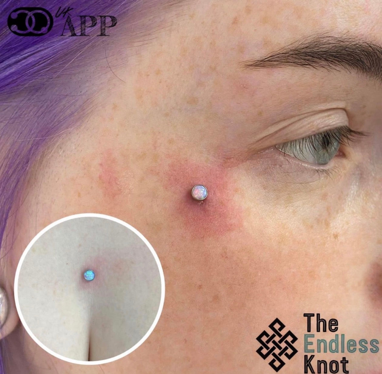 Dermal (One point piercing) / Surface