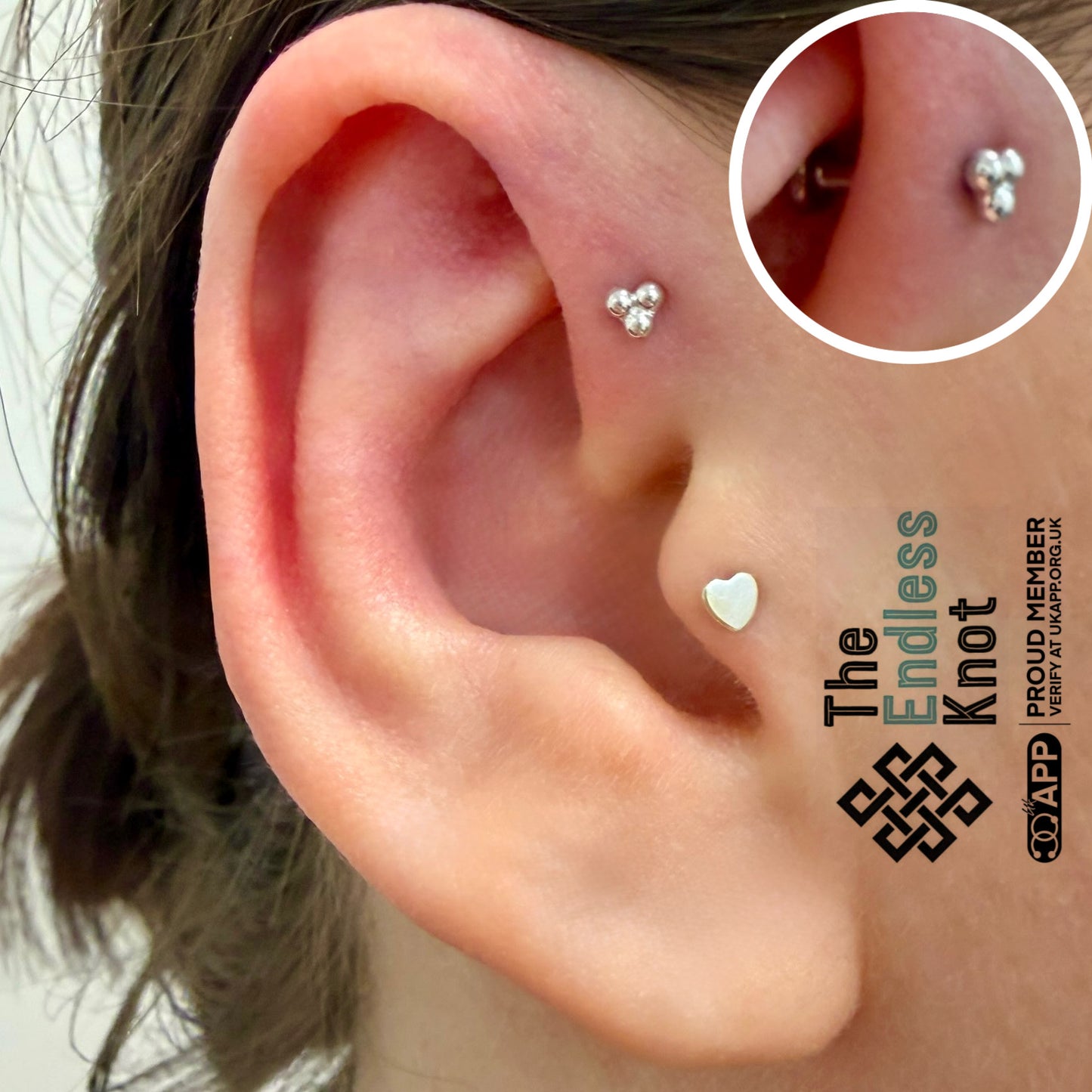 Ear cartilage (with labret)
