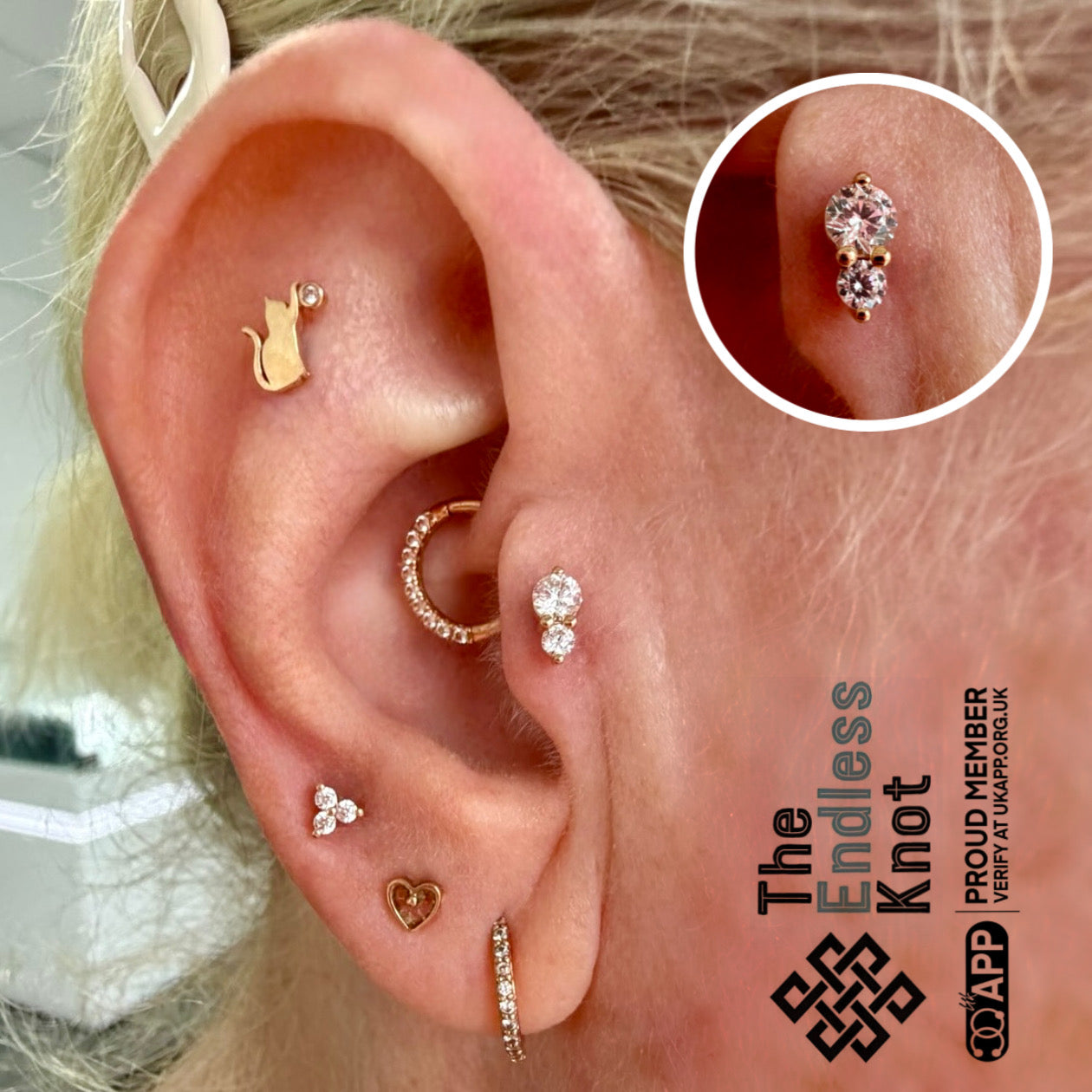 Ear cartilage (with labret)