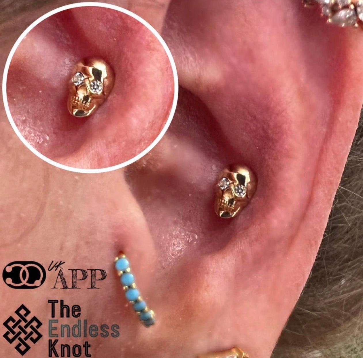 Oorkraakbeen (met labret)