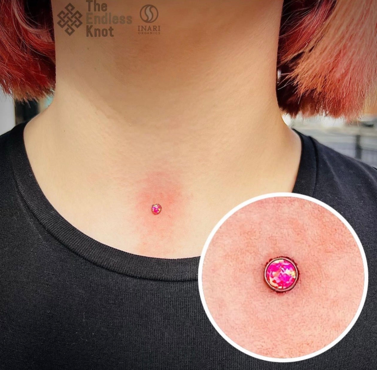 Dermal (One point piercing) / Surface