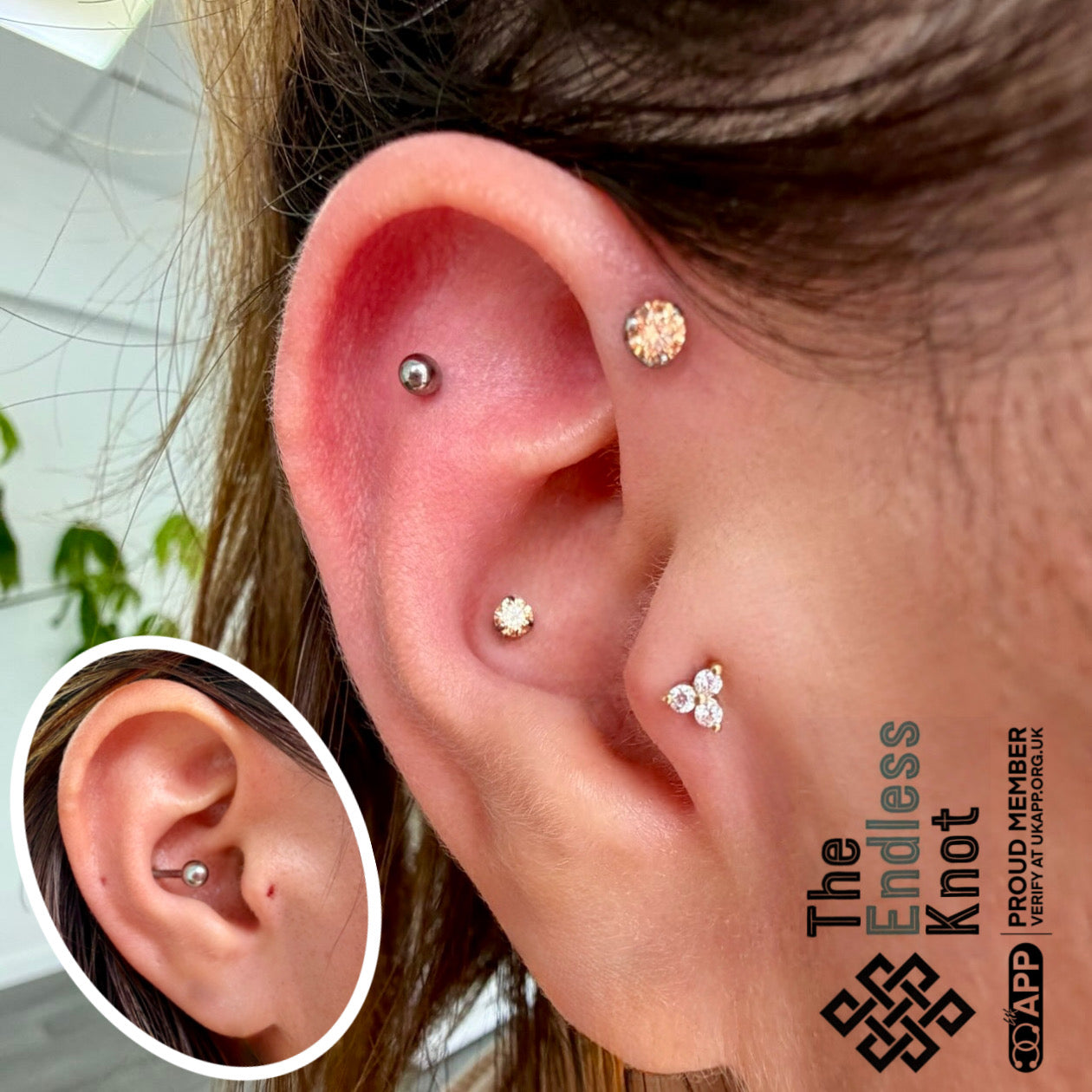 Ear cartilage (with labret)