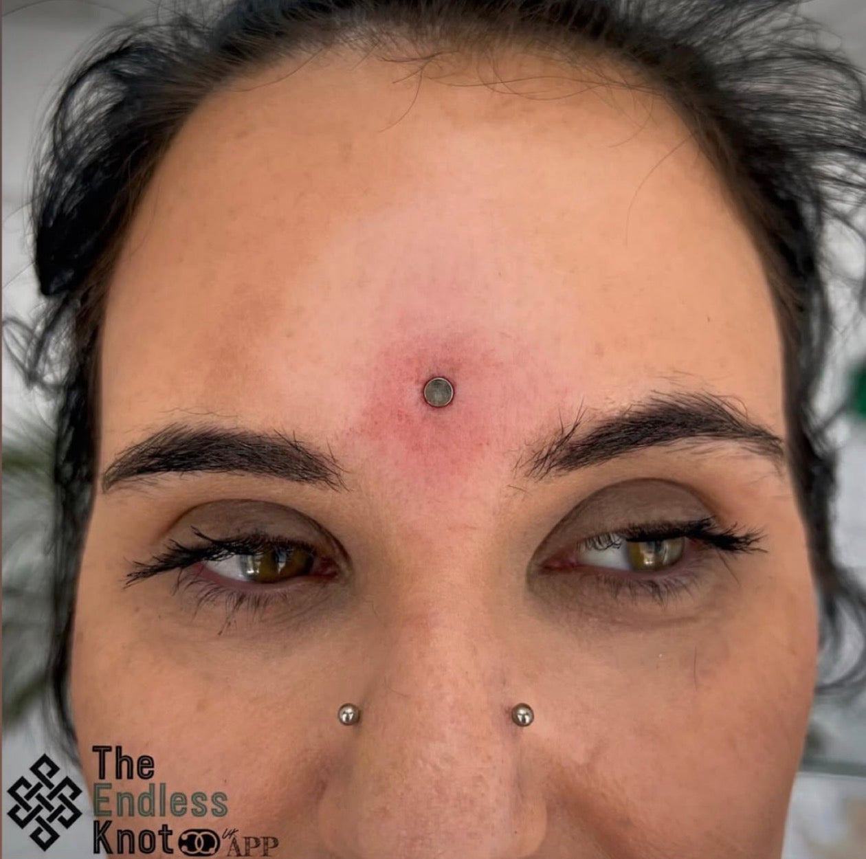 Dermal (One point piercing) / Surface