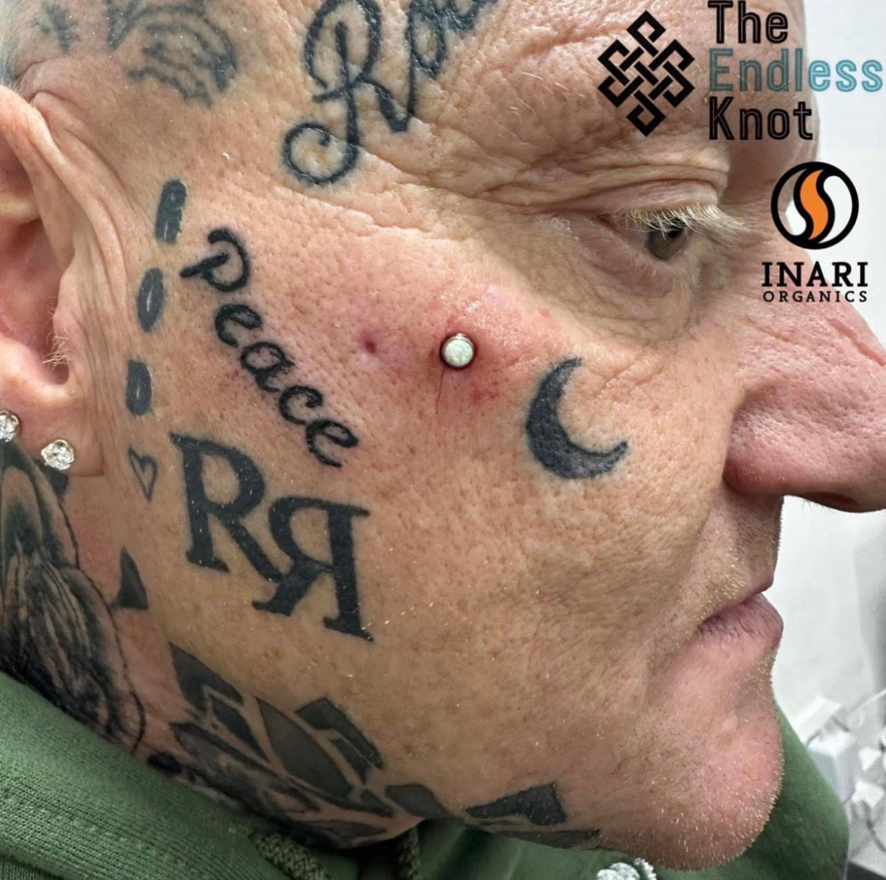 Dermal (One point piercing) / Surface