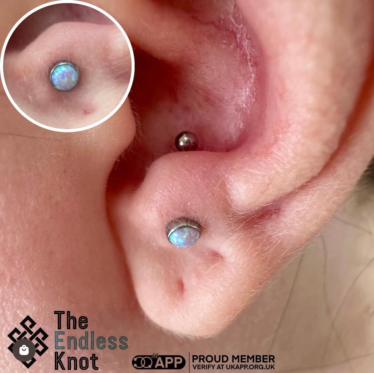 Oorkraakbeen (met labret)