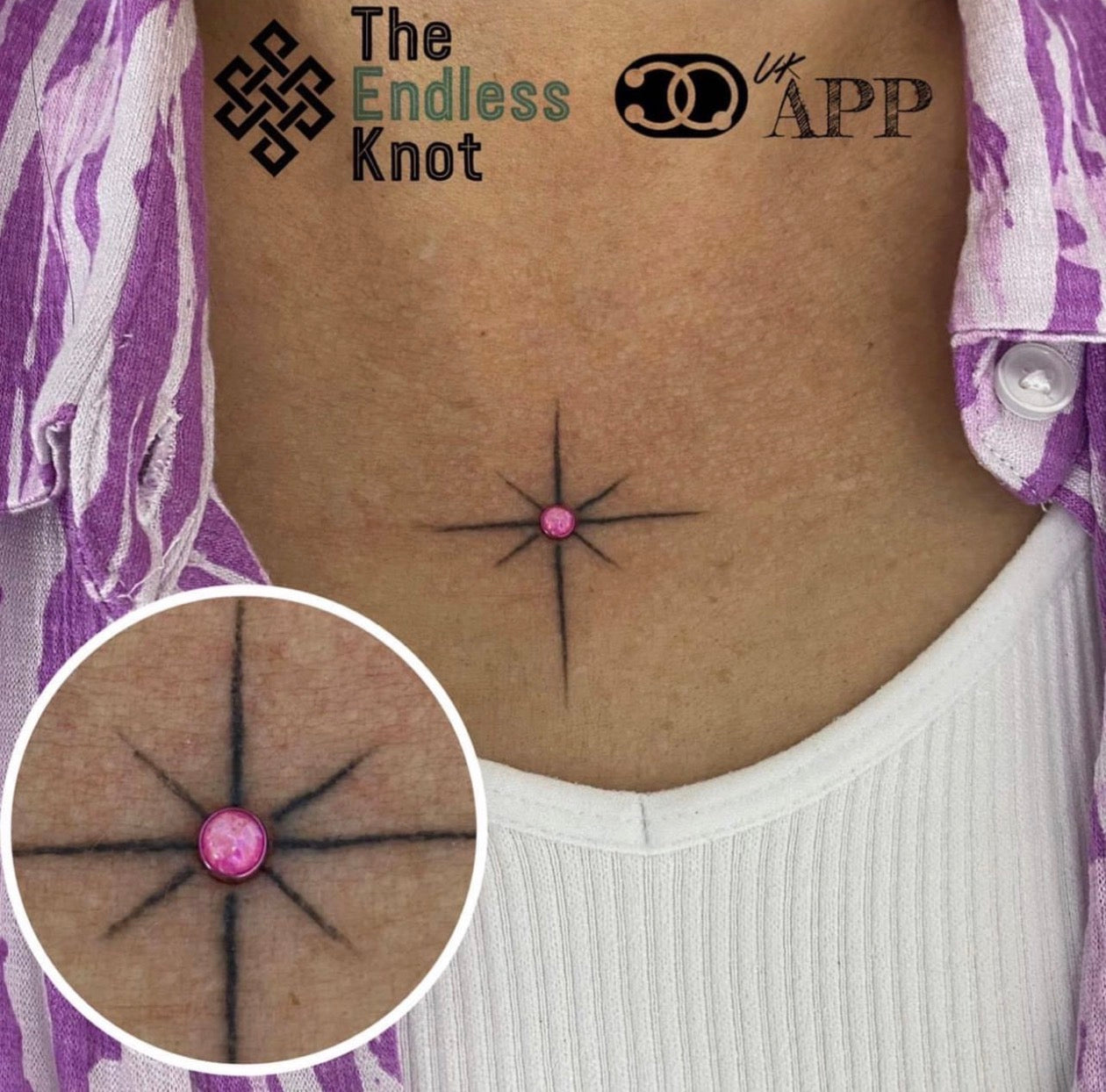 Dermal (One point piercing) / Surface