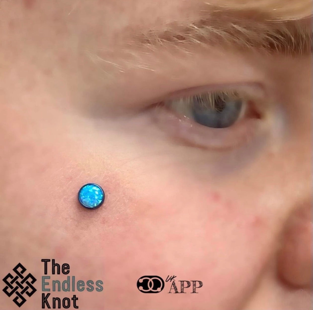 Dermal (One point piercing) / Surface