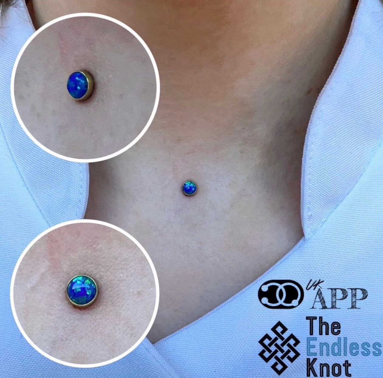 Dermal (One point piercing) / Surface