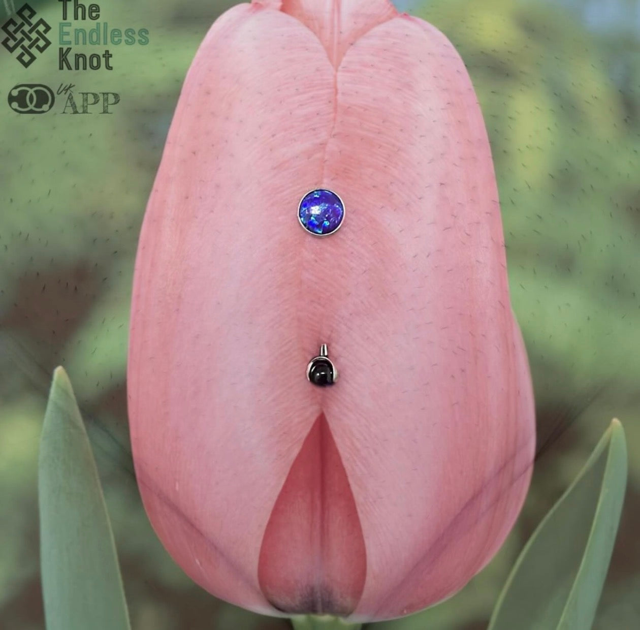 Female genitalia