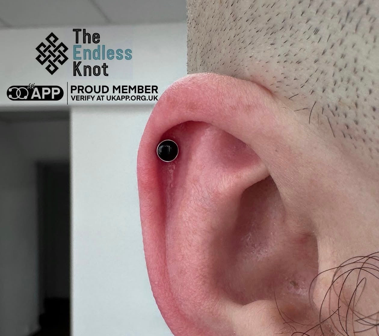 Oorkraakbeen (met labret)