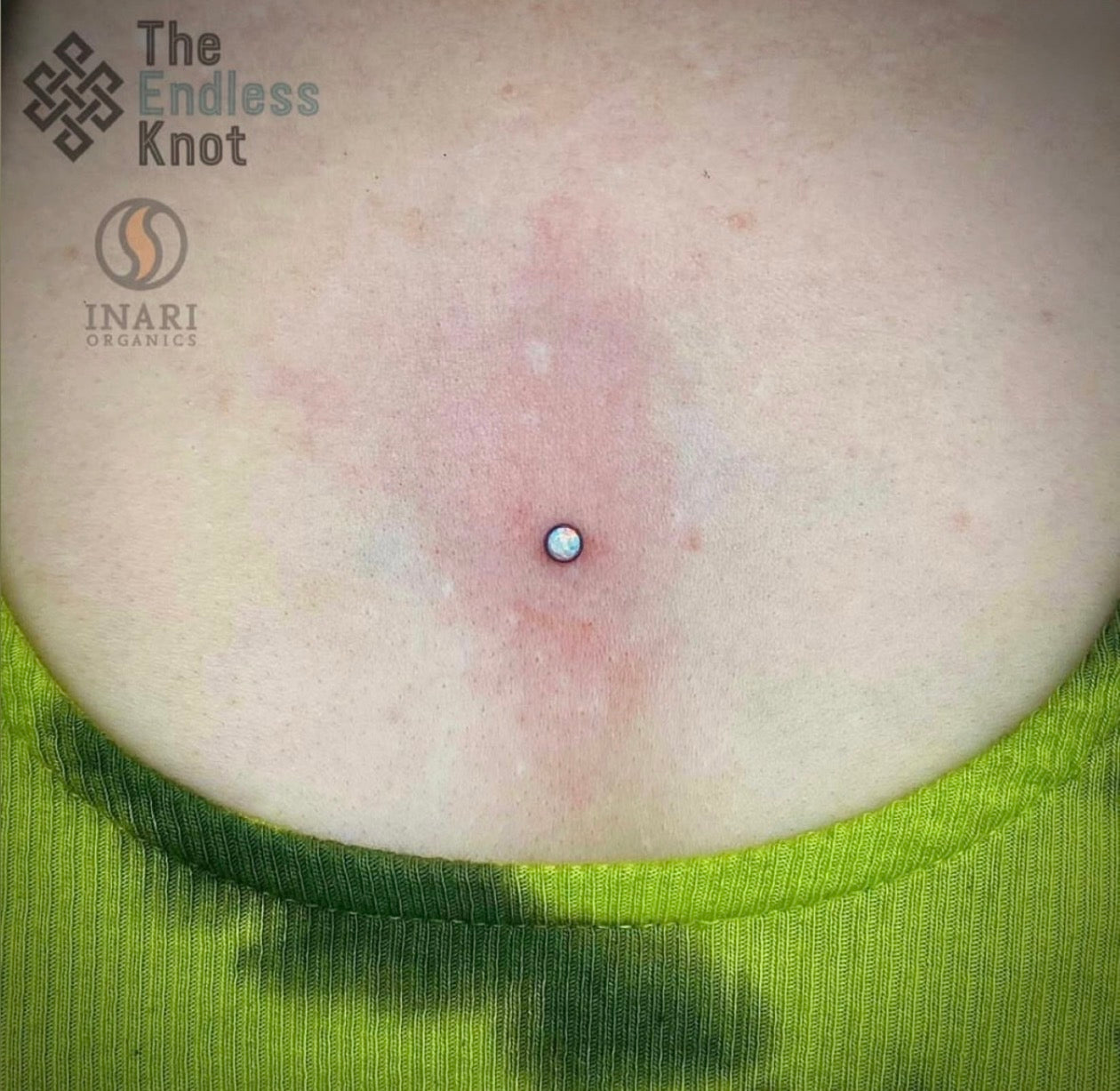 Dermal (One point piercing) / Surface