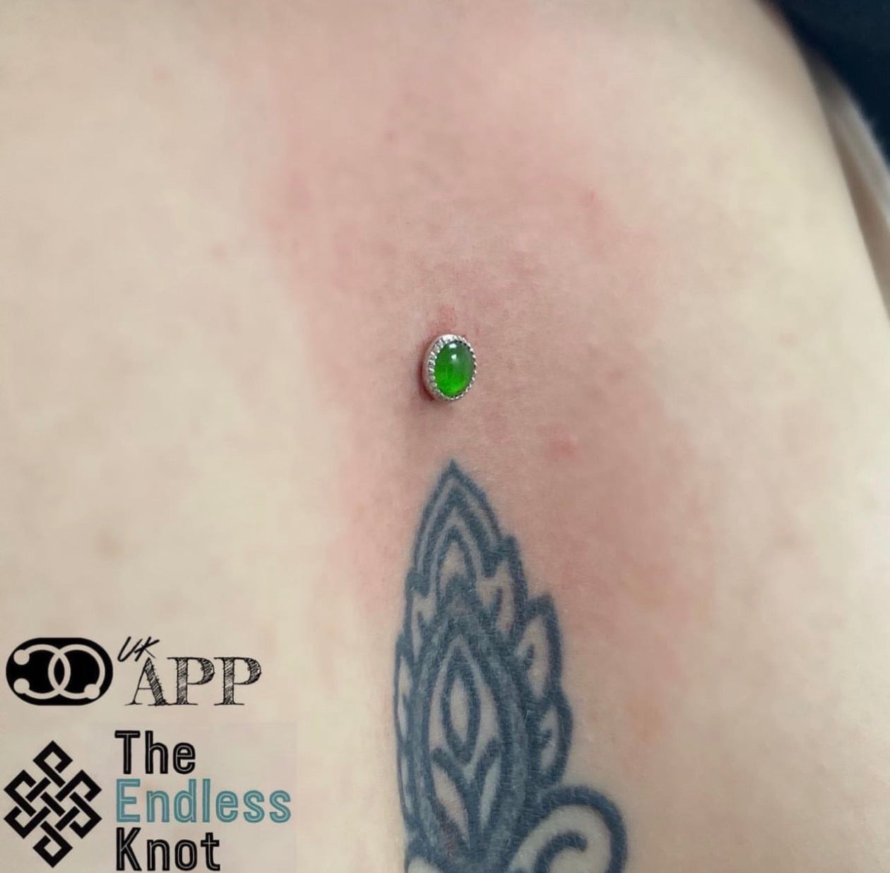 Dermal (One point piercing) / Surface