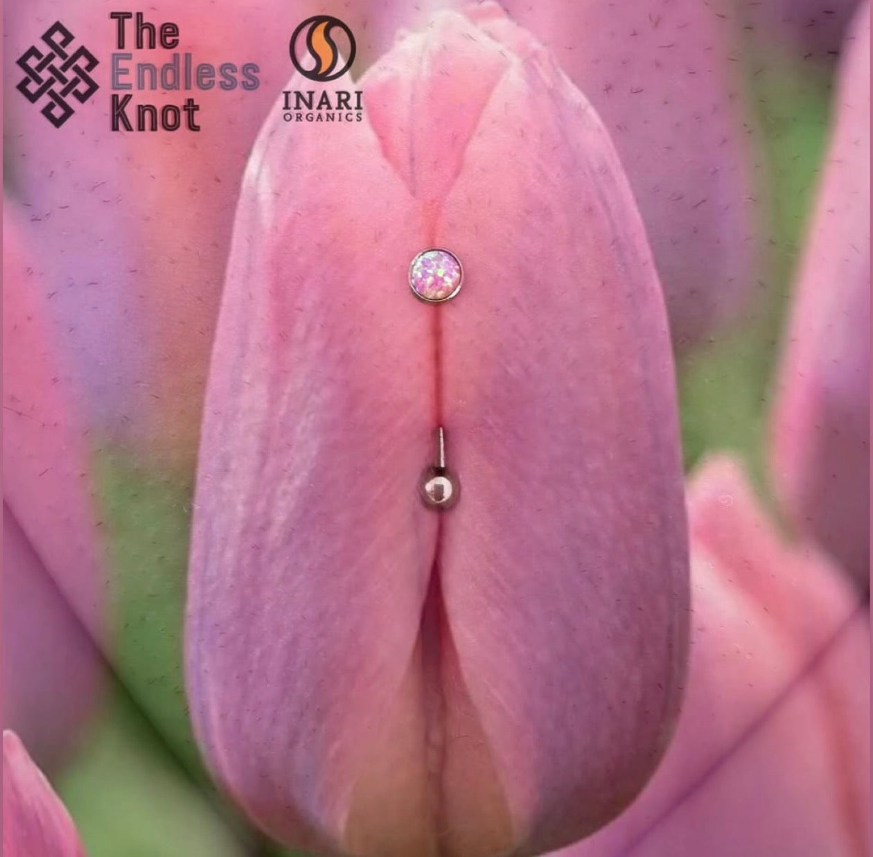 Female genitalia
